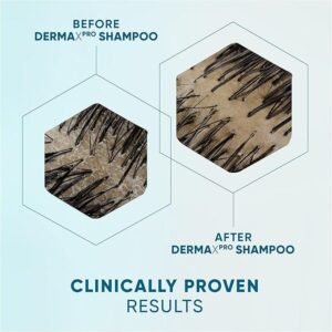 Head & Shoulders Anti-dandruff Shampoo, DermaXPRO | For Dry Scalp and Thinning Hair | 300ml (Pack of 3)